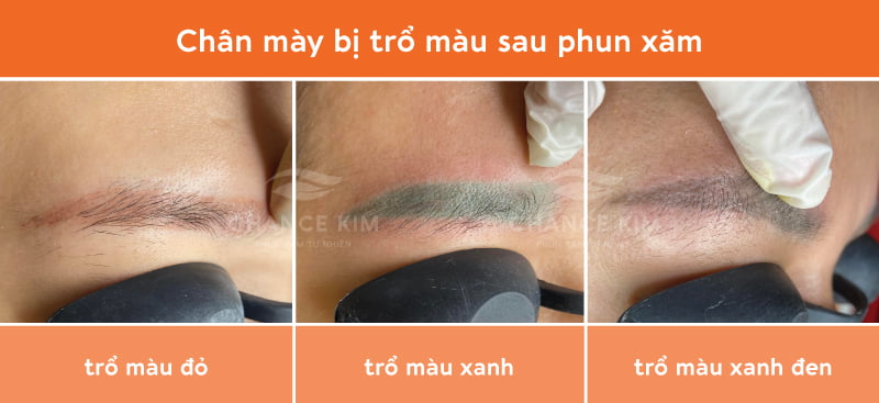 Chân mày trổ màu sau phun xăm