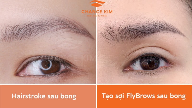 Chân mày Hairstroke sau bong lộ nhiều mảng trống