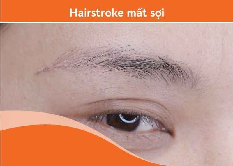 Hairstroke mất sợi