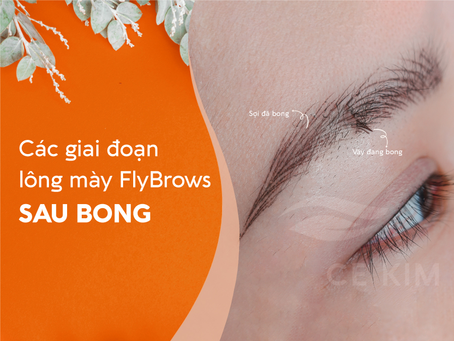 Qua trinh bong soi flybrows