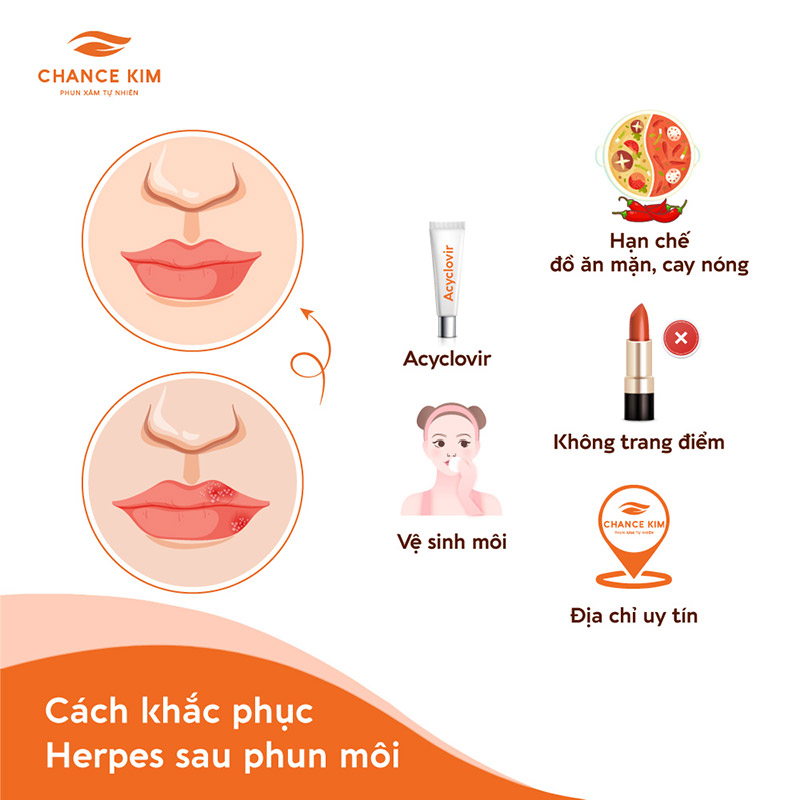 Gợi ý một số cách để cải thiện tình trạng bị Herpes sau phun môi