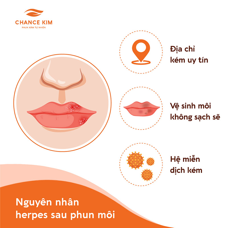 3 nguyên nhân phổ biến nhất gây ra tình trạng phun môi xong bị herpes