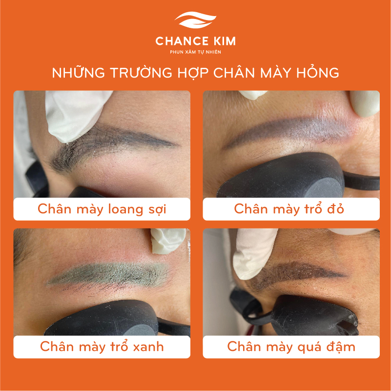 Sửa lông mày bị hỏng bằng tạo sợi FlyBrows 