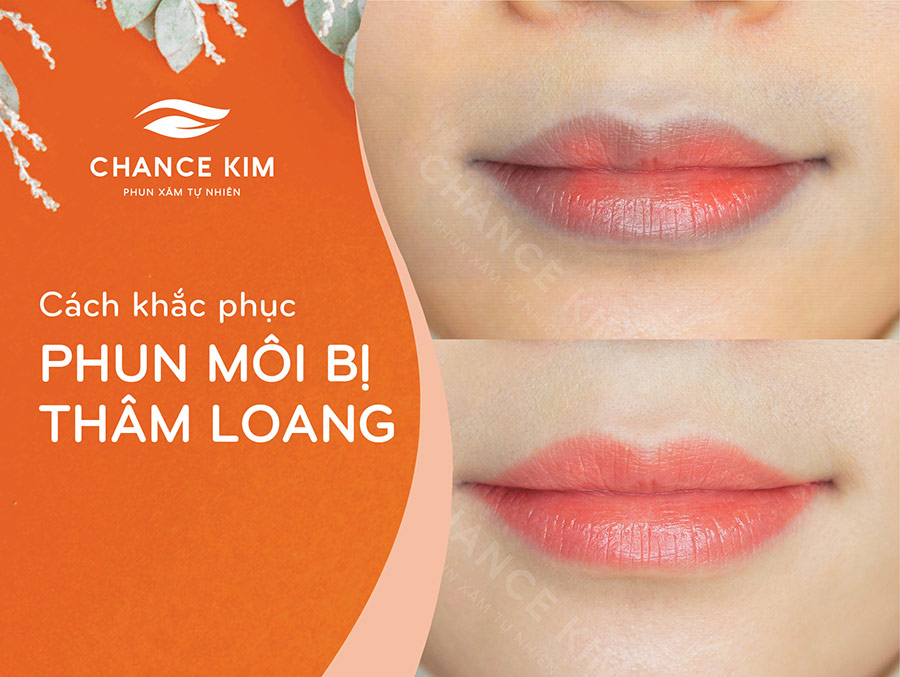Phun môi bị thâm loang - Nguyên nhân và cách khắc phục 34 thumb phun moi bi tham loang