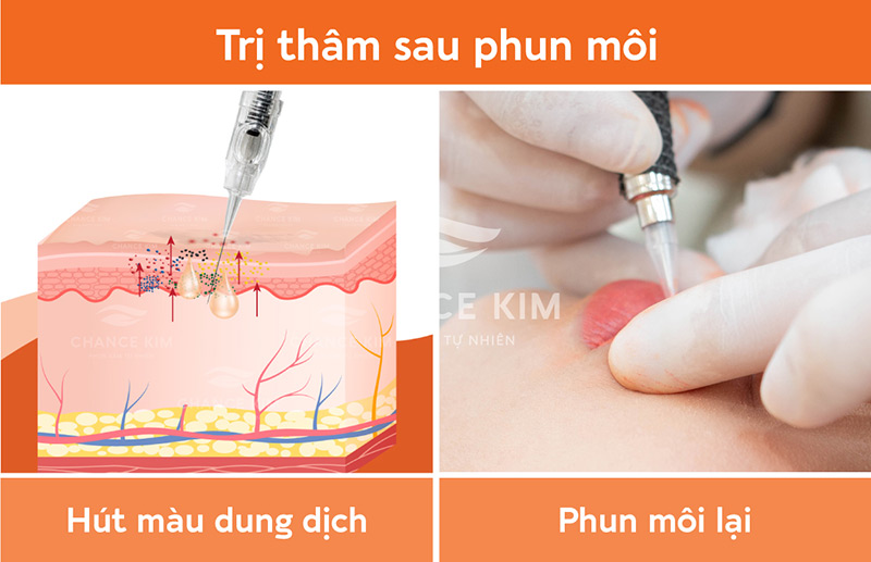 Hút màu dung dịch