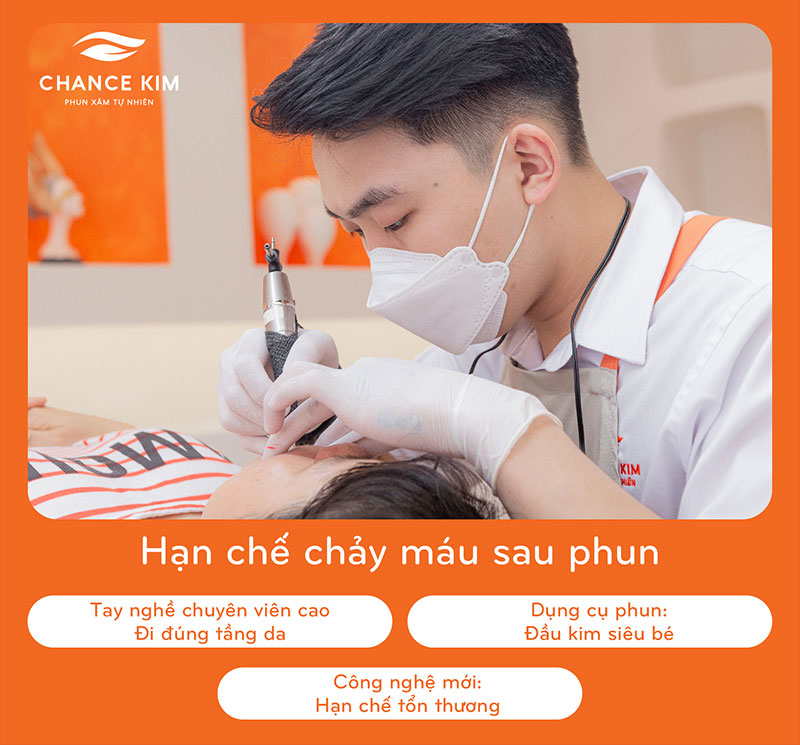 Chọn lựa địa chỉ phun môi uy tín cũng là một trong những cách hạn chế nguy cơ chảy máu sau phun môi