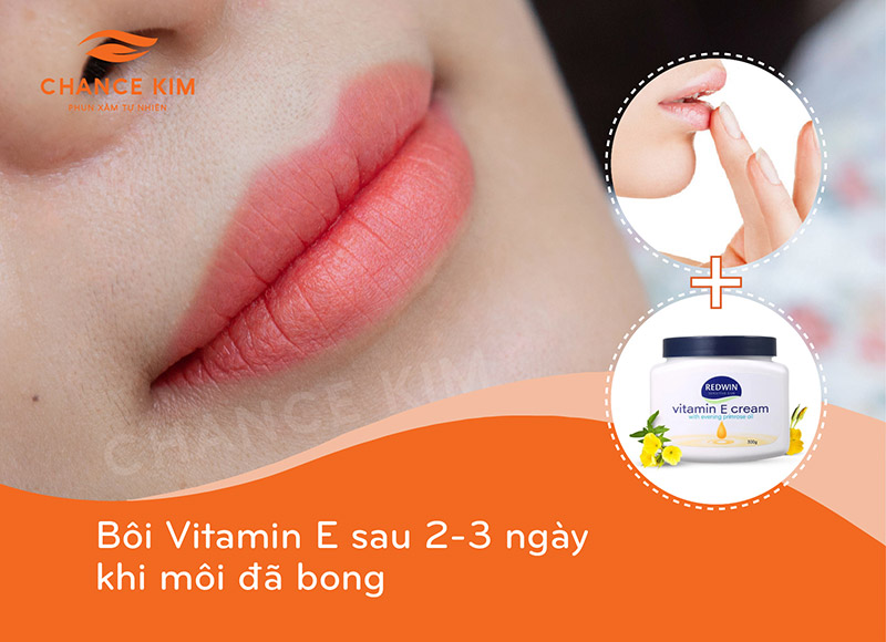 Tổng quan về Vitamin E Cream