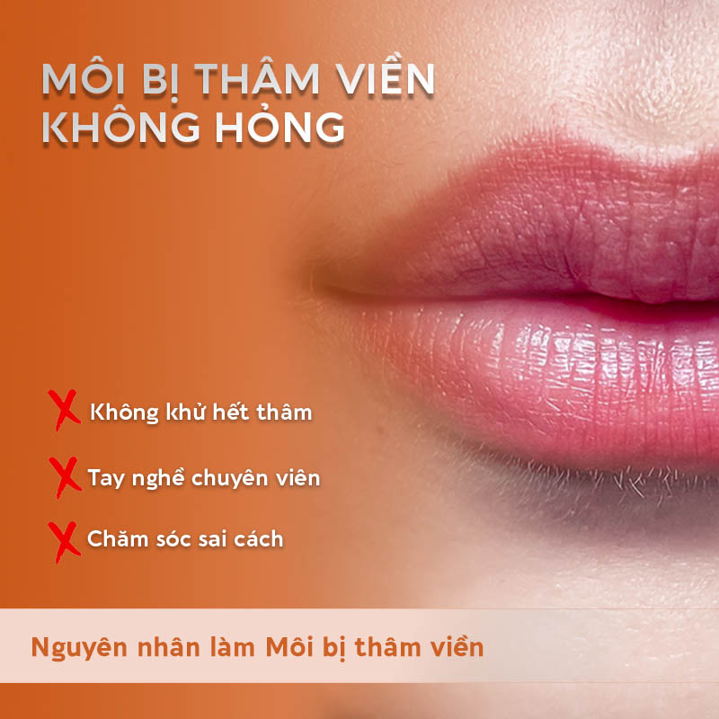 Có 3 nguyên nhân phổ biến khiến phun môi bị thâm viền