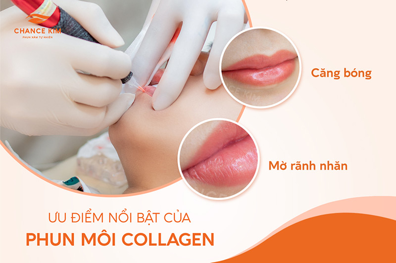 uu diem noi bat cua phun moi collagen