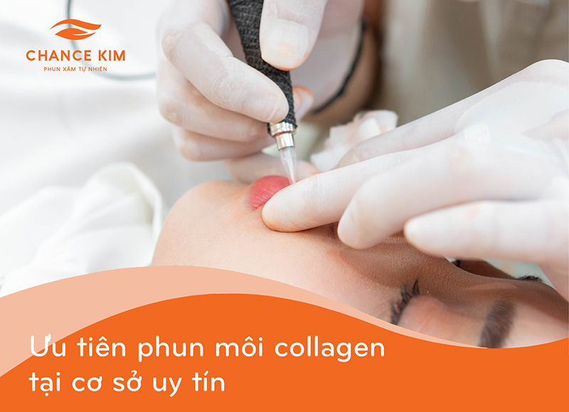 Nên lựa chọn cơ sở phun môi collagen uy tín để đảm bảo an toàn và có mức giá phù hợp