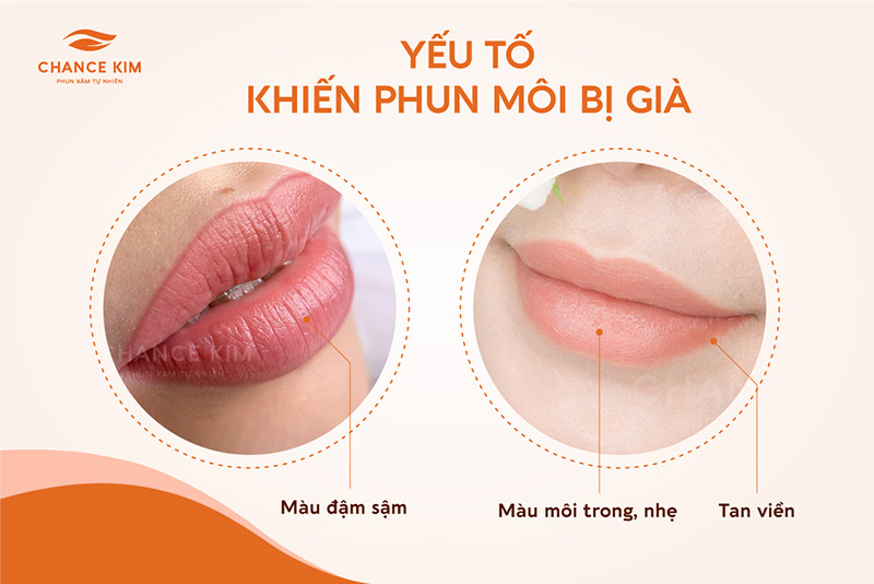 Cấy hồng môi Collagen tạo hiệu ứng căng mọng cho môi xinh  Shynh House