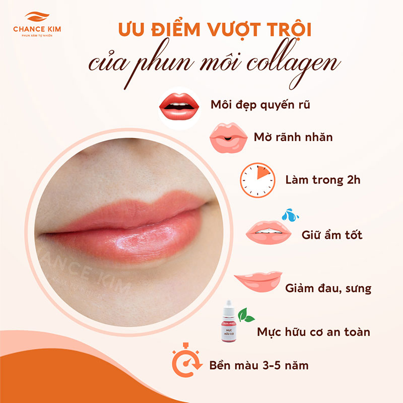 uu diem khi phun moi collagen