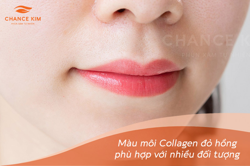 moi collagen mau do hong