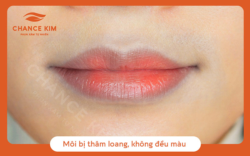 Phun môi không đều màu là tình trạng phun môi không đều màu, chỗ đậm chỗ nhạt