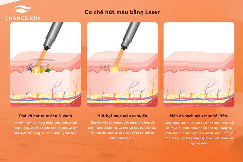 co che hut mau laser