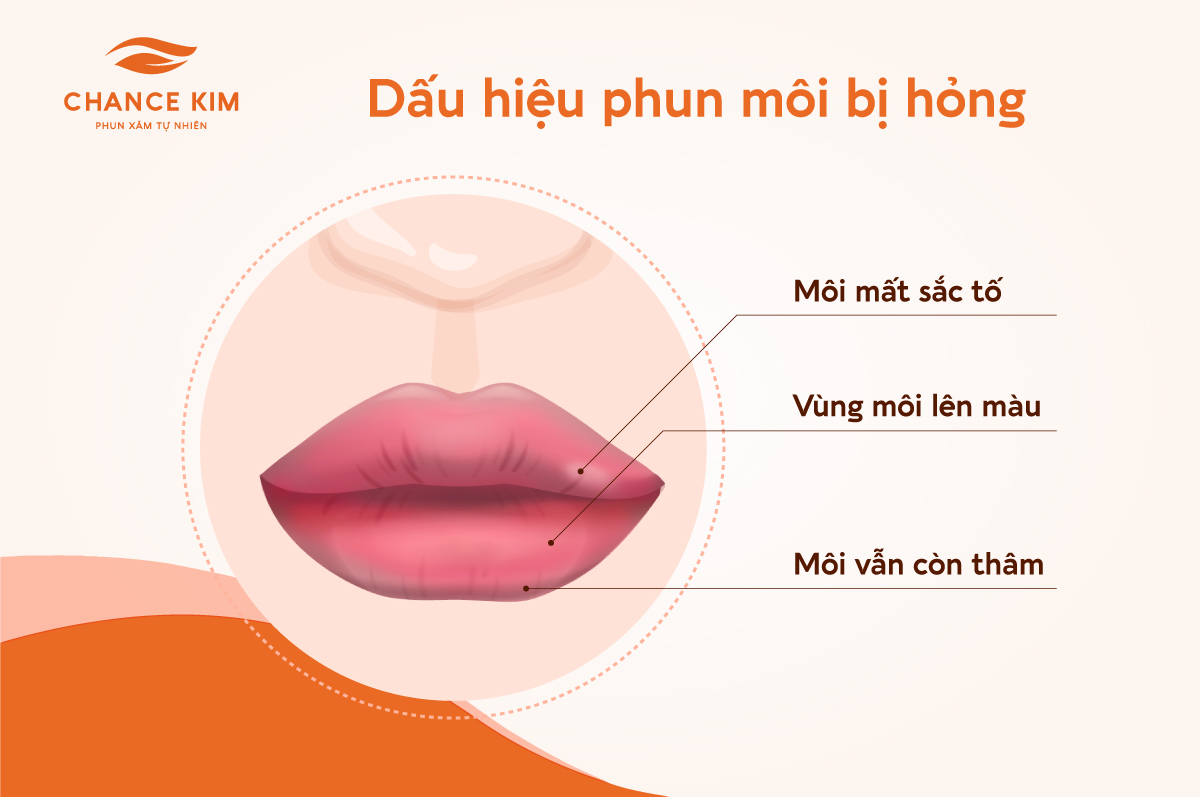 Phun môi không đều màu phải làm sao? Nguyên nhân là gì?