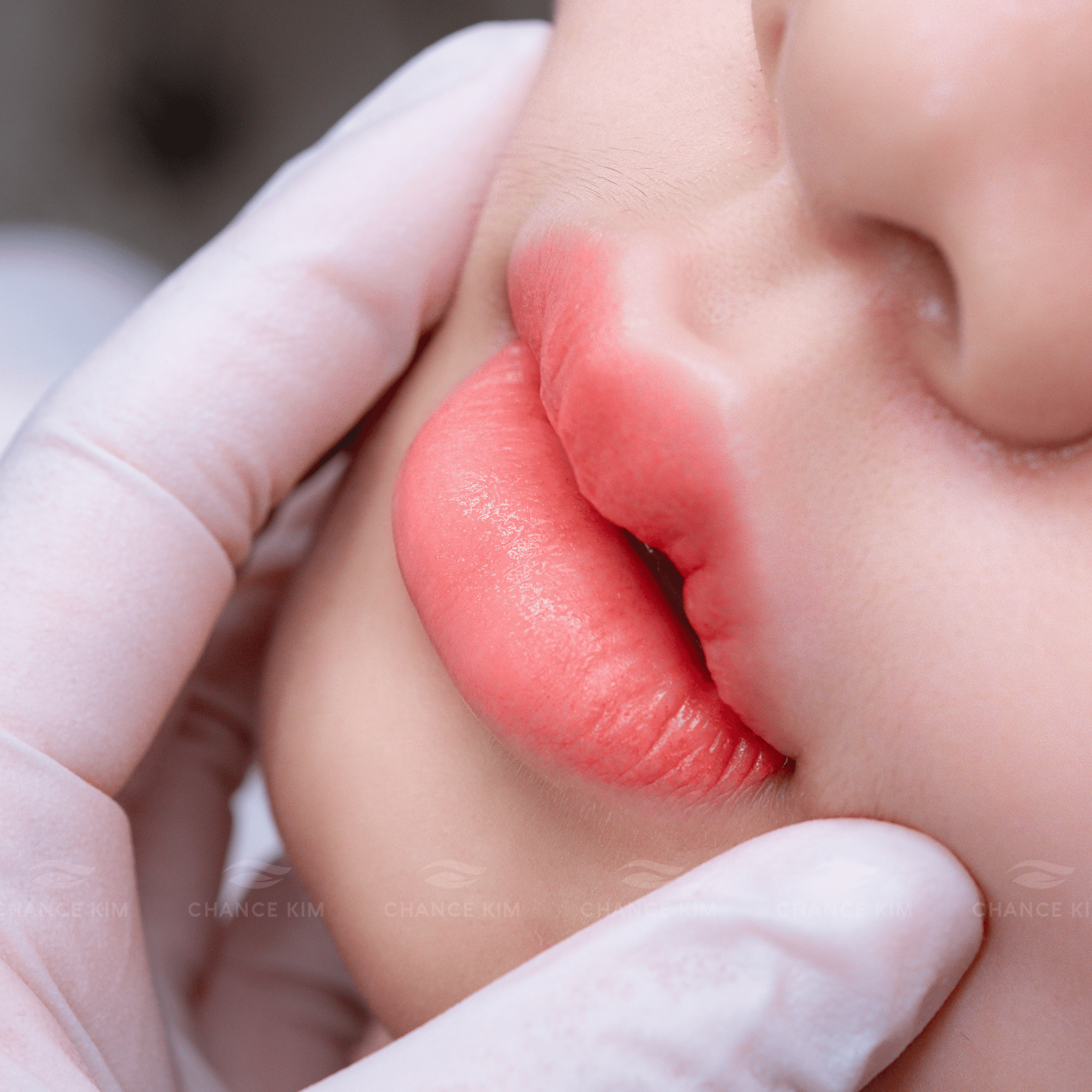 Cam kết an toàn với công nghệ phun môi Lips Mix Collagen