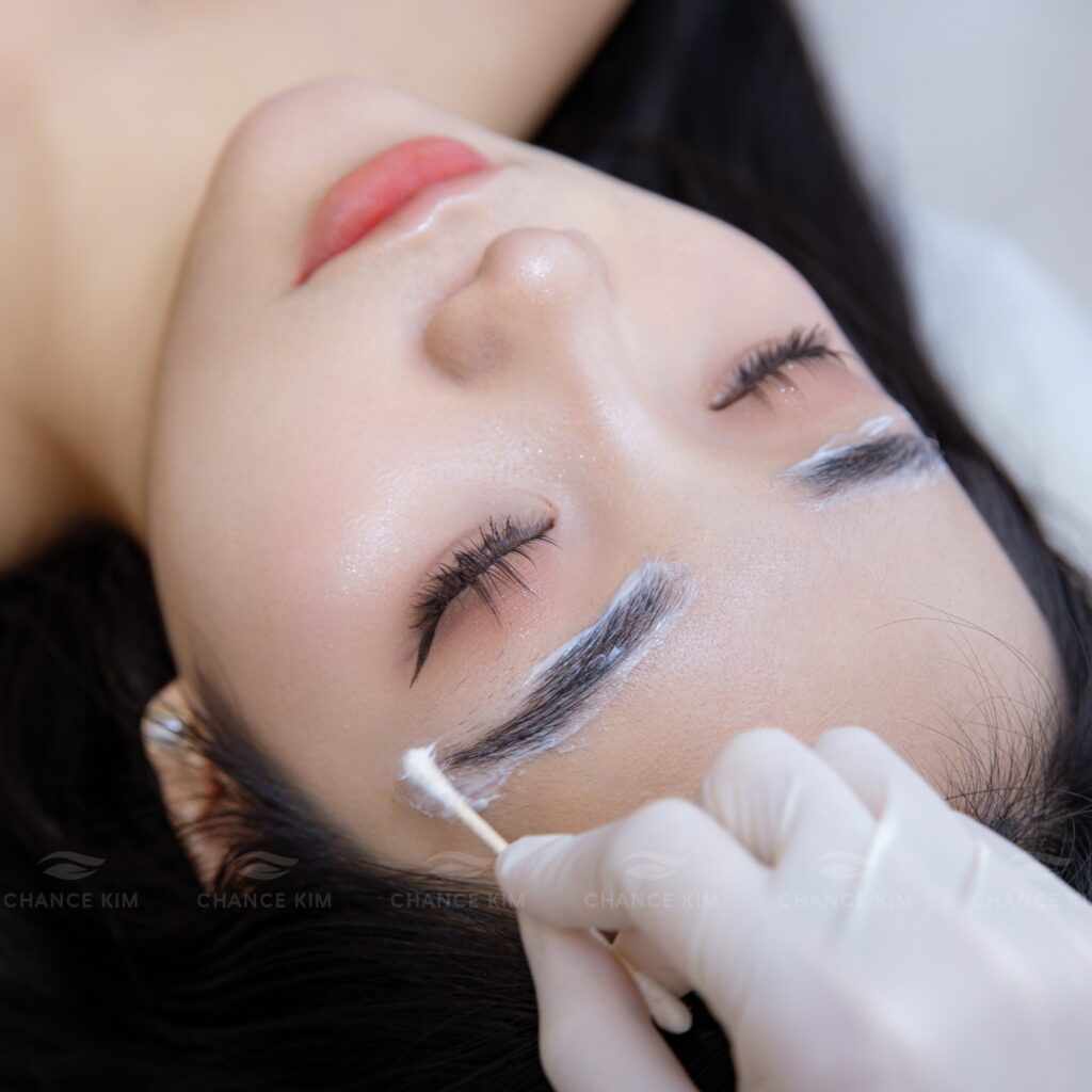quy trinh xoa xam long may laser boi te 1024x1024 1